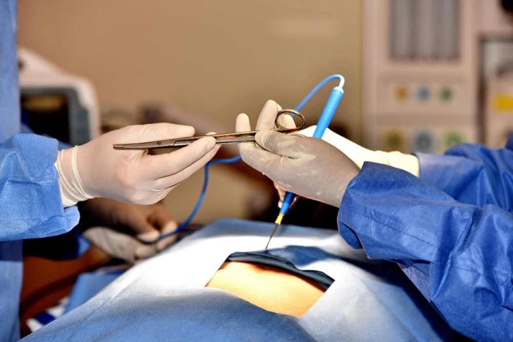 Laparoscopic Procedures